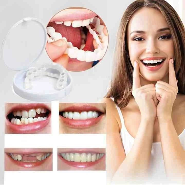 SnapOn Gebiss – Easy-Click Dentalprothese für ein selbstbewusstes, strahlendes Lächeln