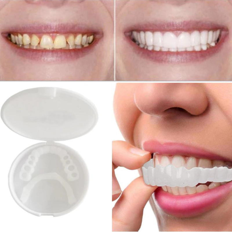 SnapOn Gebiss – Easy-Click Dentalprothese für ein selbstbewusstes, strahlendes Lächeln